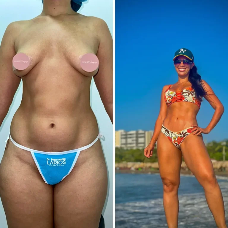 Mommy make over 1 año de evolución